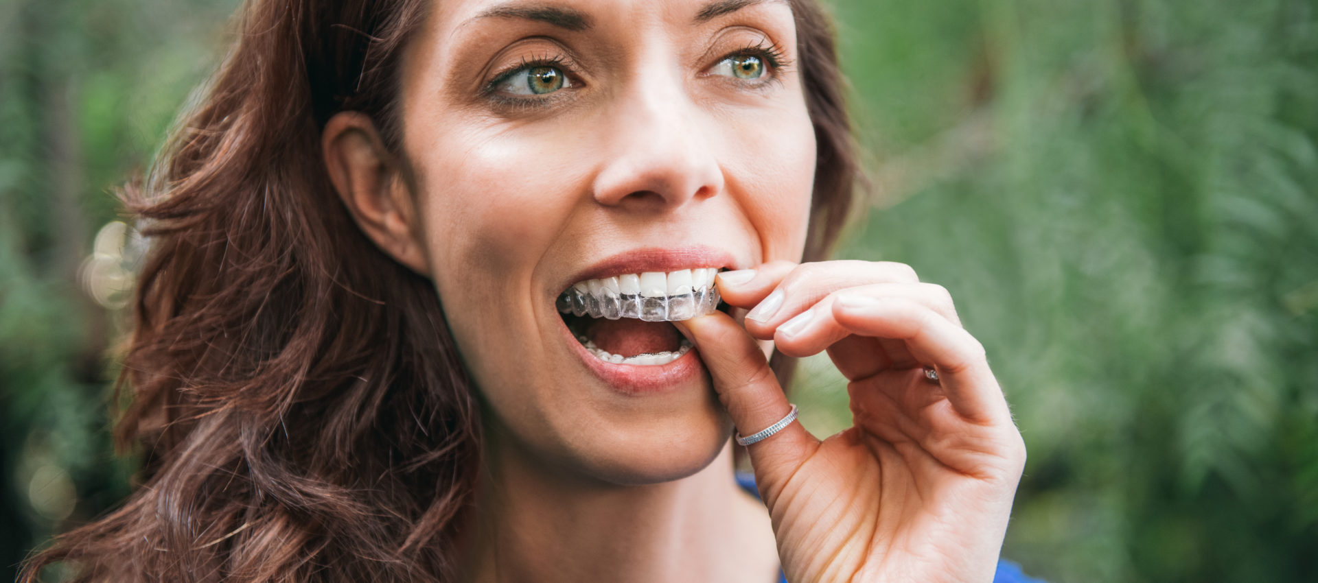 neviditeľný strojček na zuby invisalign